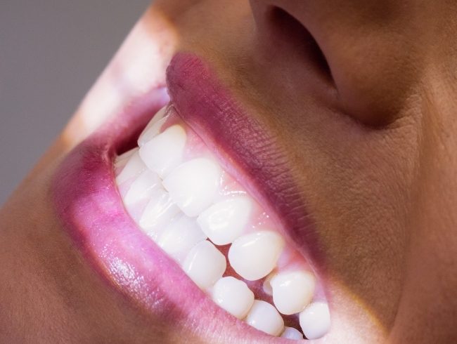 female-patient-receiving-dental-treatment